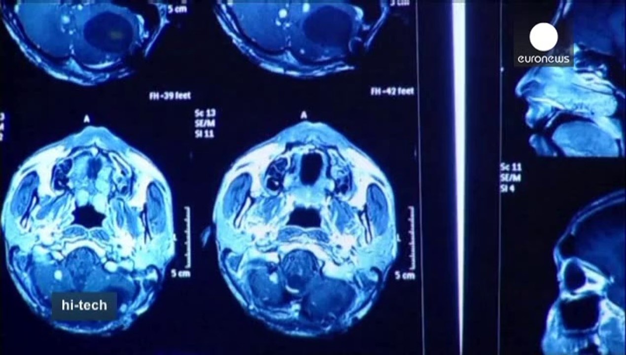 Nuestro cerebro en 4D