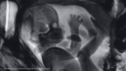 Life Through An MRI Will Blow Your Mind