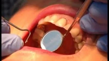 A Few Simple Tips For Great Dentist