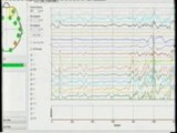 Amor y sincronizacion cerebral (EEG): Emotiv-Epoc