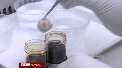 ¿Cómo se extraen y almacenan córneas para trasplantar?