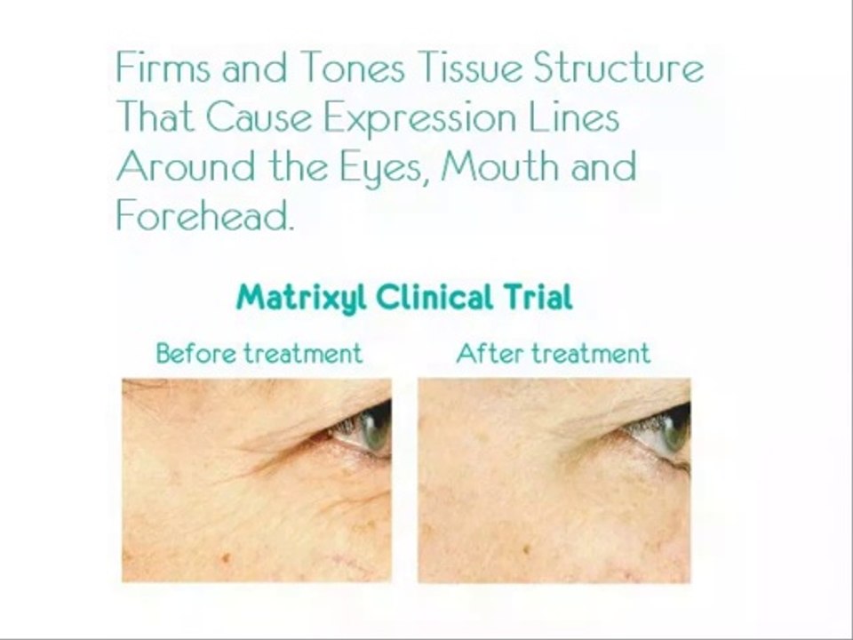 Smoother-Looking Skin Is Easy With Top Rated Wrinkle Cream