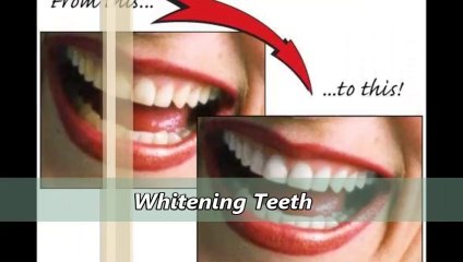 Free Consultations by Cosmetic Dentists