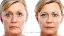 Facial Plastic Surgery of Beaumont Injectable Fillers Procedure