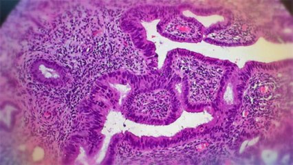 Gynaecology Centres Australia