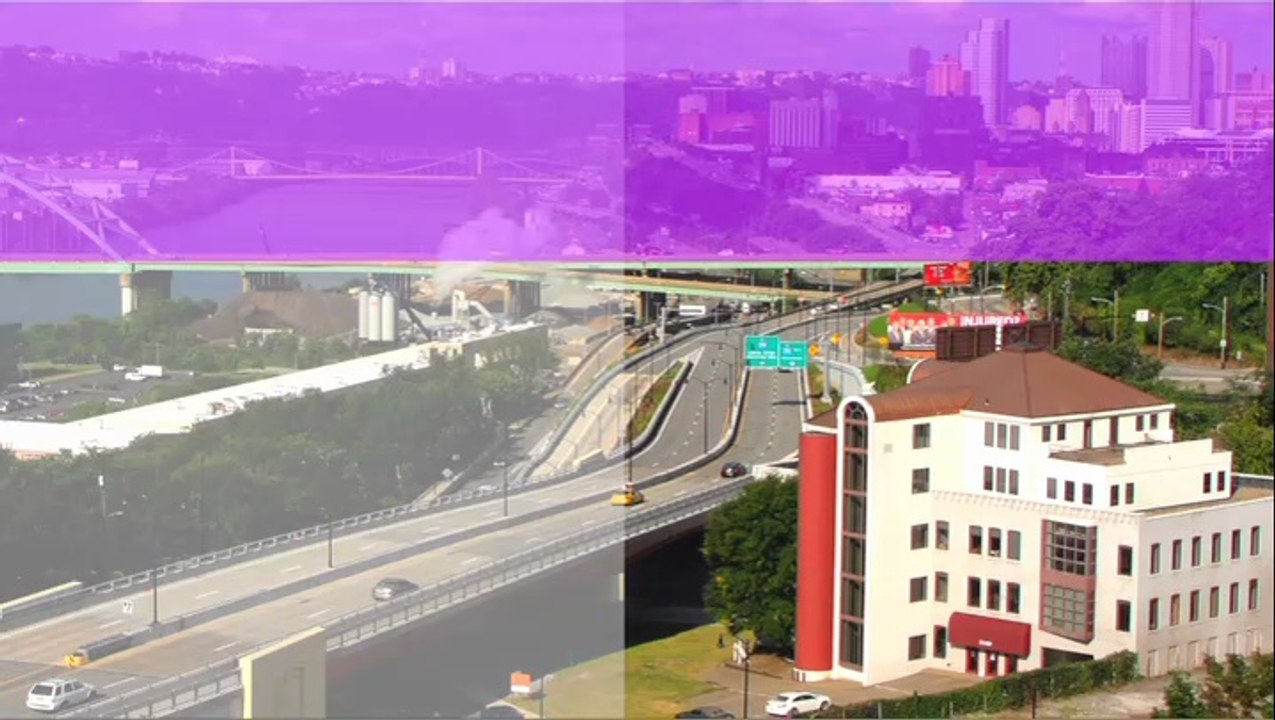 Facial Sculpting - Pittsburgh - Hurwitz Center for Plastic Surgery