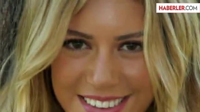 Sinem Kobal'a 'Çarpık Diş' Operasyonu