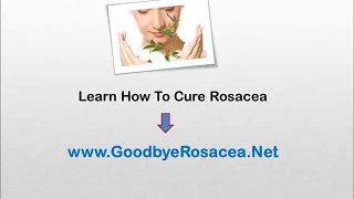 Rosacea Home Treatment - treat rosacea without medication
