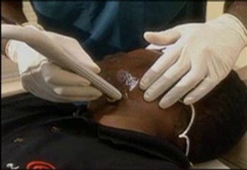 Effective Hair Reduction Methods ✨