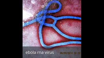 What You Really Need to Know About Ebola