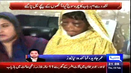 Lahore: child domestic labourer severely beaten, tortured by govt official's wife