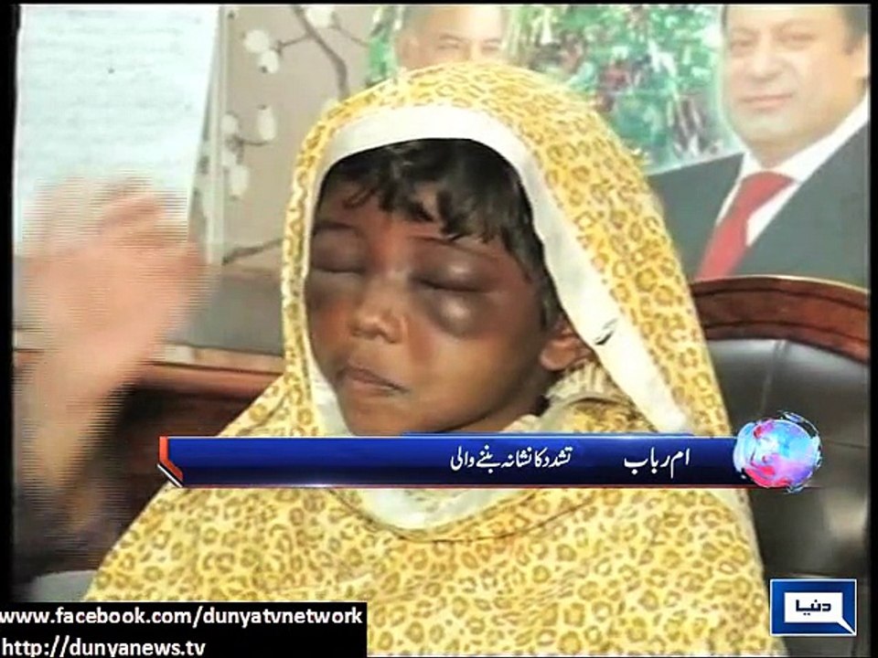 Dunya news- Lahore: child domestic labourer severely beaten, tortured by govt official's wife