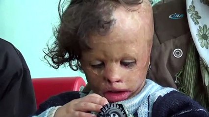 O daha küçücük: Yardım elinizi uzatın