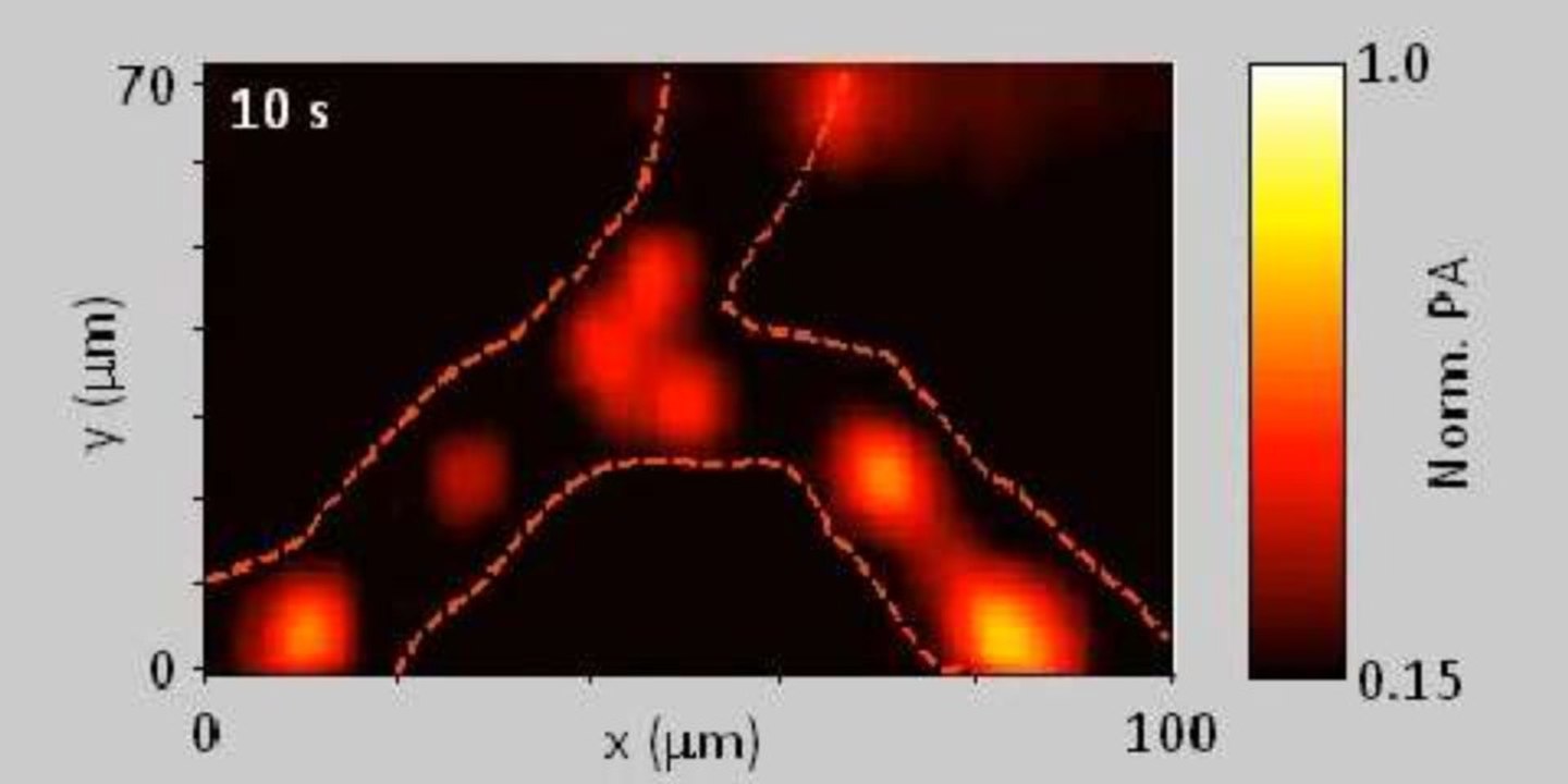 Le flux de globules rouges en temps réel