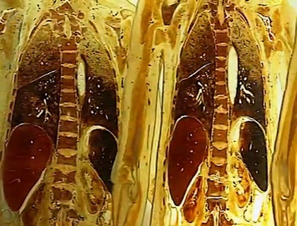 The Anatomical Exhibition of Real Human Bodies.