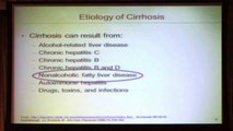 Treating Complications of Cirrhosis | Steven–Huy Han, MD | UCLA Digestive Diseases