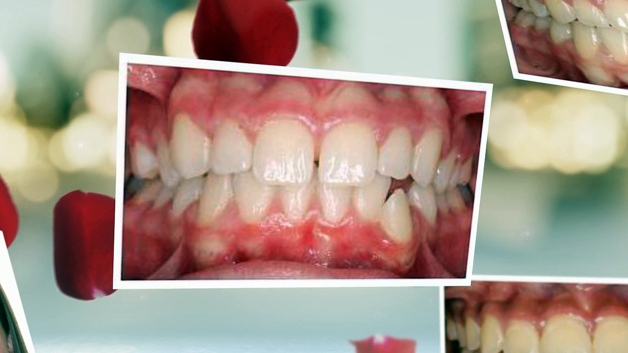 Ebert Fort Collins Orthodontics - (970) 490-6065