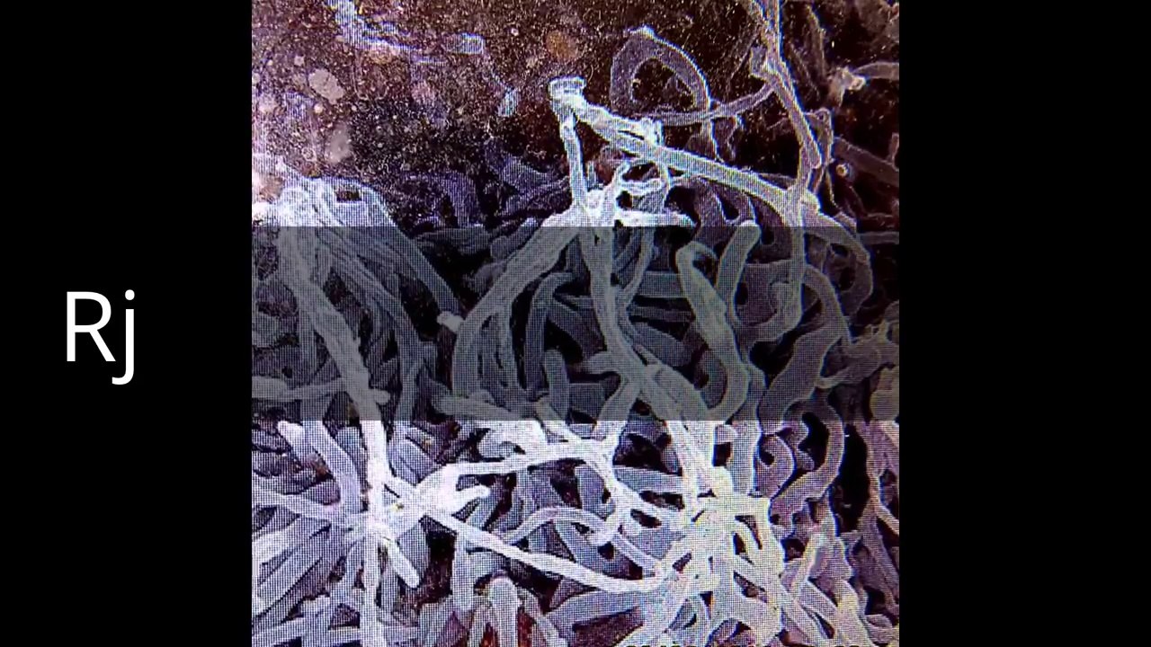 How the Nurse Nina got Ebola in Dallas R J news