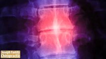 Englewood FL Finds Back Pain Solution at Joseph Family Chiropractic