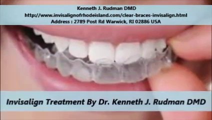 Kenneth J. Rudman DMD Invisible Braces RI