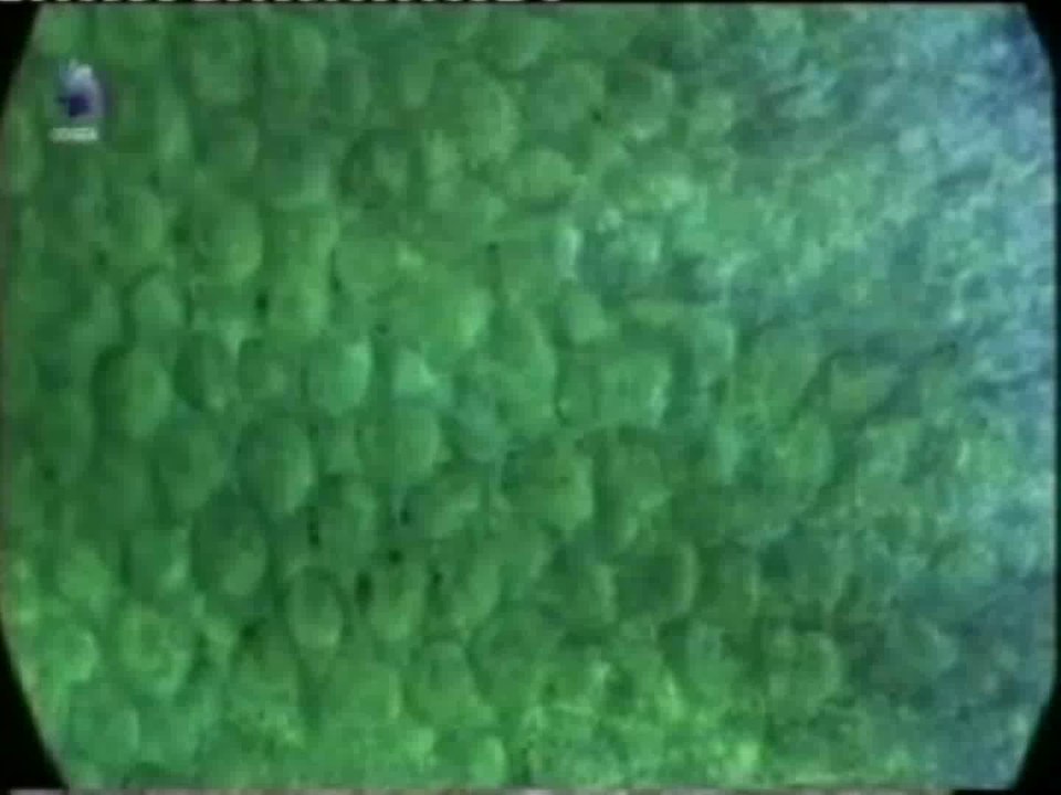 Estereocilios: Oidos que cantan