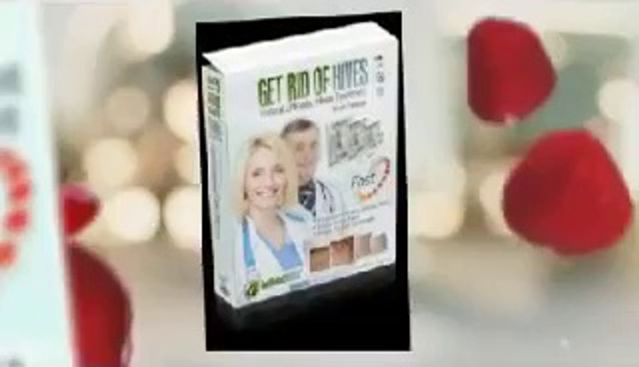 Get Rid Of Hives a Natural Way to remove hives