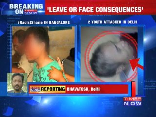 Another racist shame: NE youth beaten up