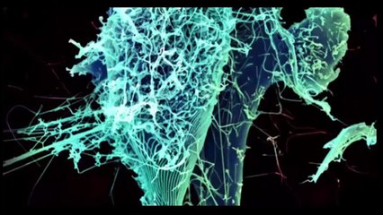 Ebola checklist 'Now is the time to prepare