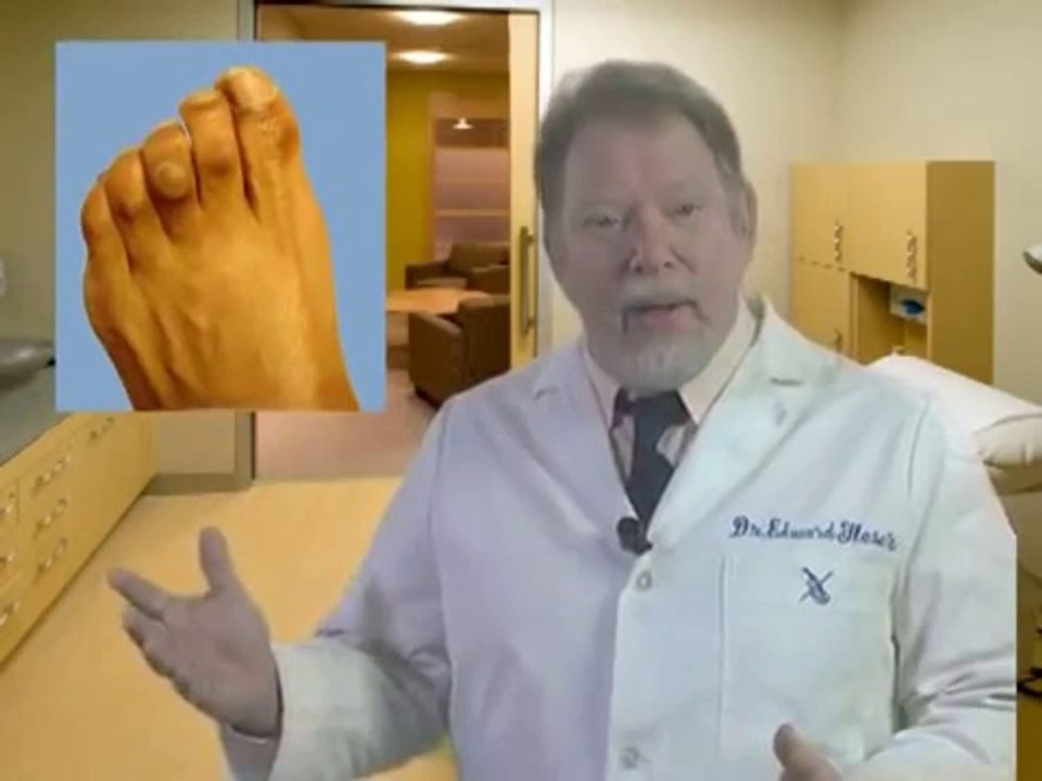 Custom Orthotics Review - Best Orthotics for Plantar Fasciitis