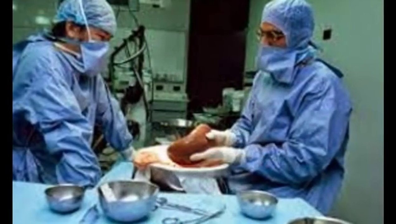 Liver Transplantation In India - Transplant Counsellor