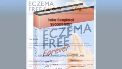 Eczema Free Forever Review