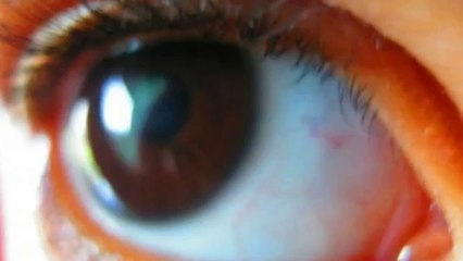 Watch Vision Without Glasses Review Before You Buy This Program. Heal Your Eyesight Now!