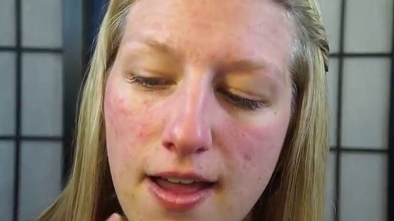 Stay Fabulous Foundation Routine for Acne, Rosacea, Redness, Dark Circles, and Bags!