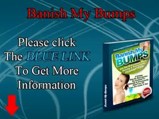 Banish My Bumps How to Cure Keratosis Pilaris Naturally