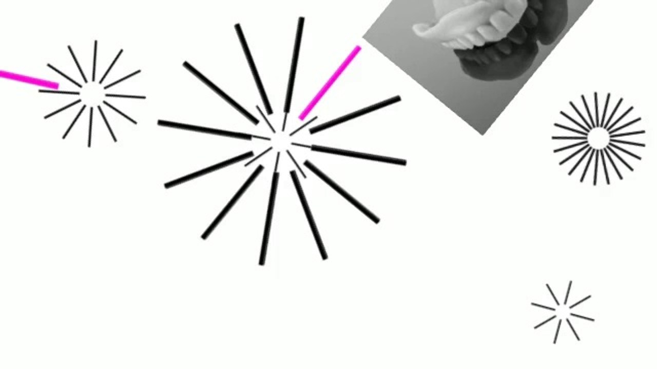 dental implants or bridge