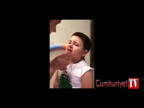 Süper etkili bir diş çekme yöntemi