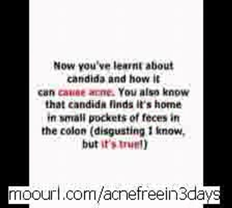 Be  Acne Free In 3 Days