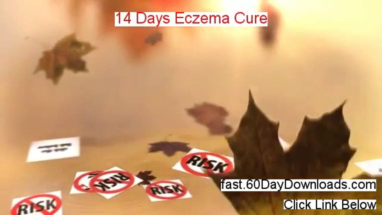14 Days Eczema Cure Review (Best 2014 PDF Review)