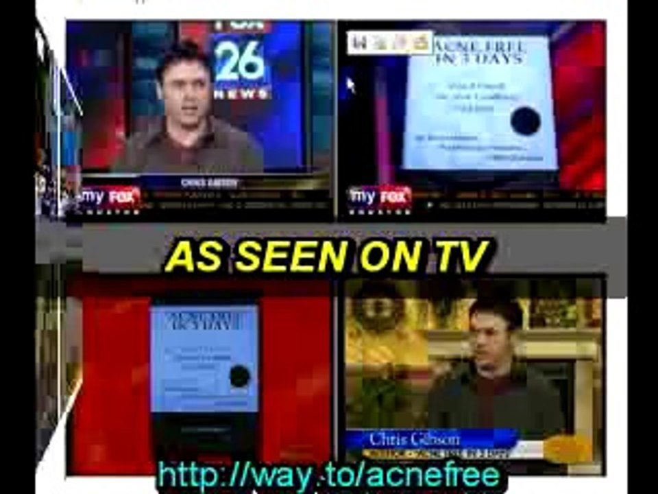 Acne Free in 3 Days Get rid of Acne Pimples about