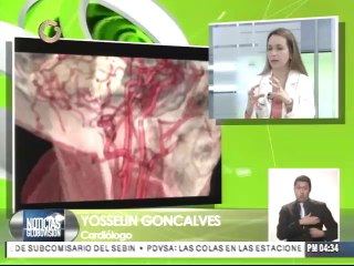 1 de cada 4 personas mayores de 40 años pueden padecer de arritmia