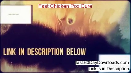 Access Fast Chicken Pox Cure free of risk (for 60 days)
