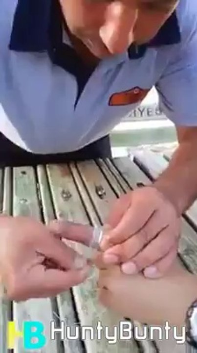 How to remove a jammed ring from your finger