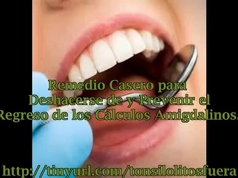 Remedios secretos caseros para los calculos amigdalinos