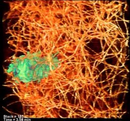 HIGH-TECH. Un nouveau microscope filme l'intérieur des cellules en 3D