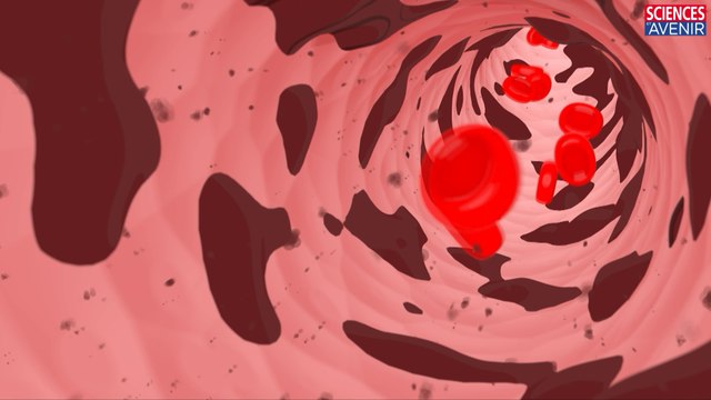 2 minutes pour comprendre le virus Ebola