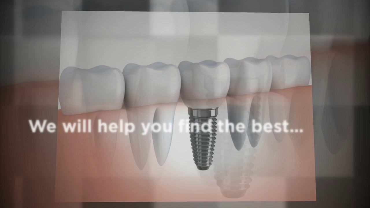 Dental Implants Manchester