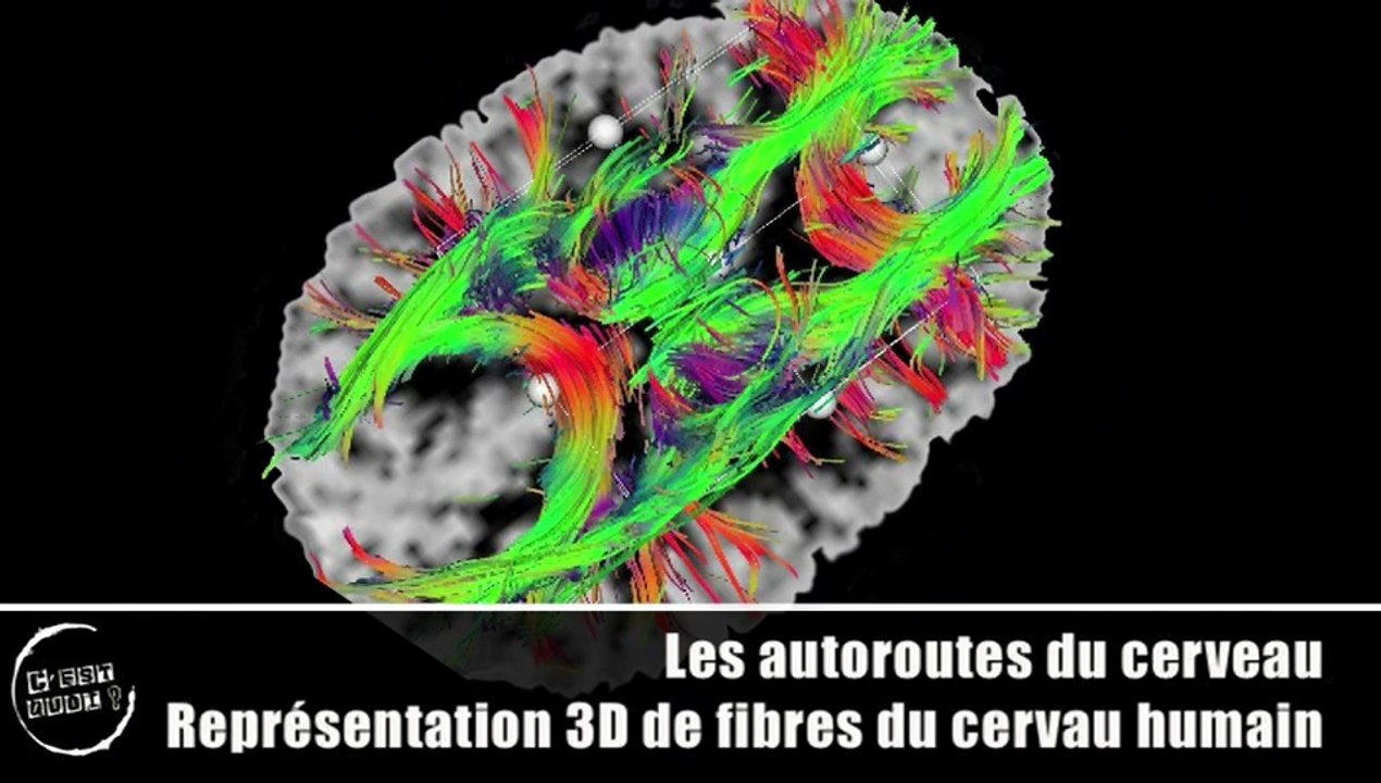C'est quoi le cerveau ?