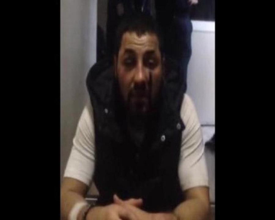 Polisi satırla yaralayan gence karakolda dayak iddiası