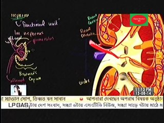কিডনি বিক্রি ও দালাল চক্র -এই ভিডিও শুধু সবল ও সাহসীদের জন্য যাদের হার্ট দুর্বল তারা দেখবেন না
