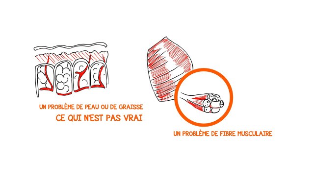 Comment Se Débarrasser De La Cellulite Définitivement Avec Des Méthodes Naturelles